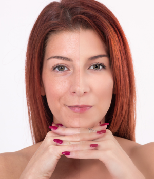 Rejuvenescimento Facial